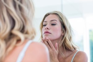 Discover Nutrafol Skin Acne Formula: Clear Skin from Within 