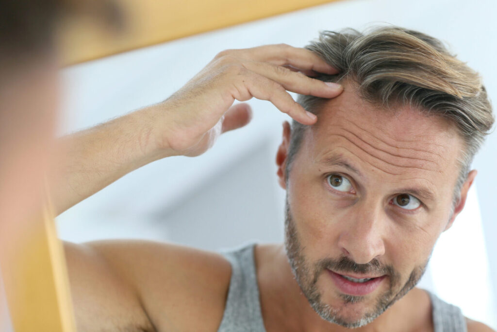 5 Ways to Combat Men’s Hair Loss with Nutrafol 